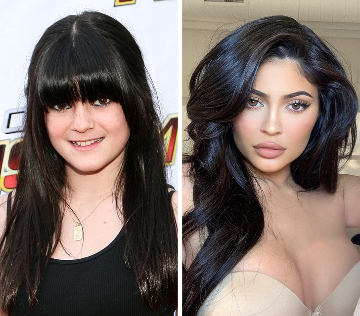 Kylie Jenner đang là một trong những nữ tỉ phú trẻ của thế giới. 10 năm trước, cô nàng sở hữu gương mặt kém thon, không mấy ấn tượng.