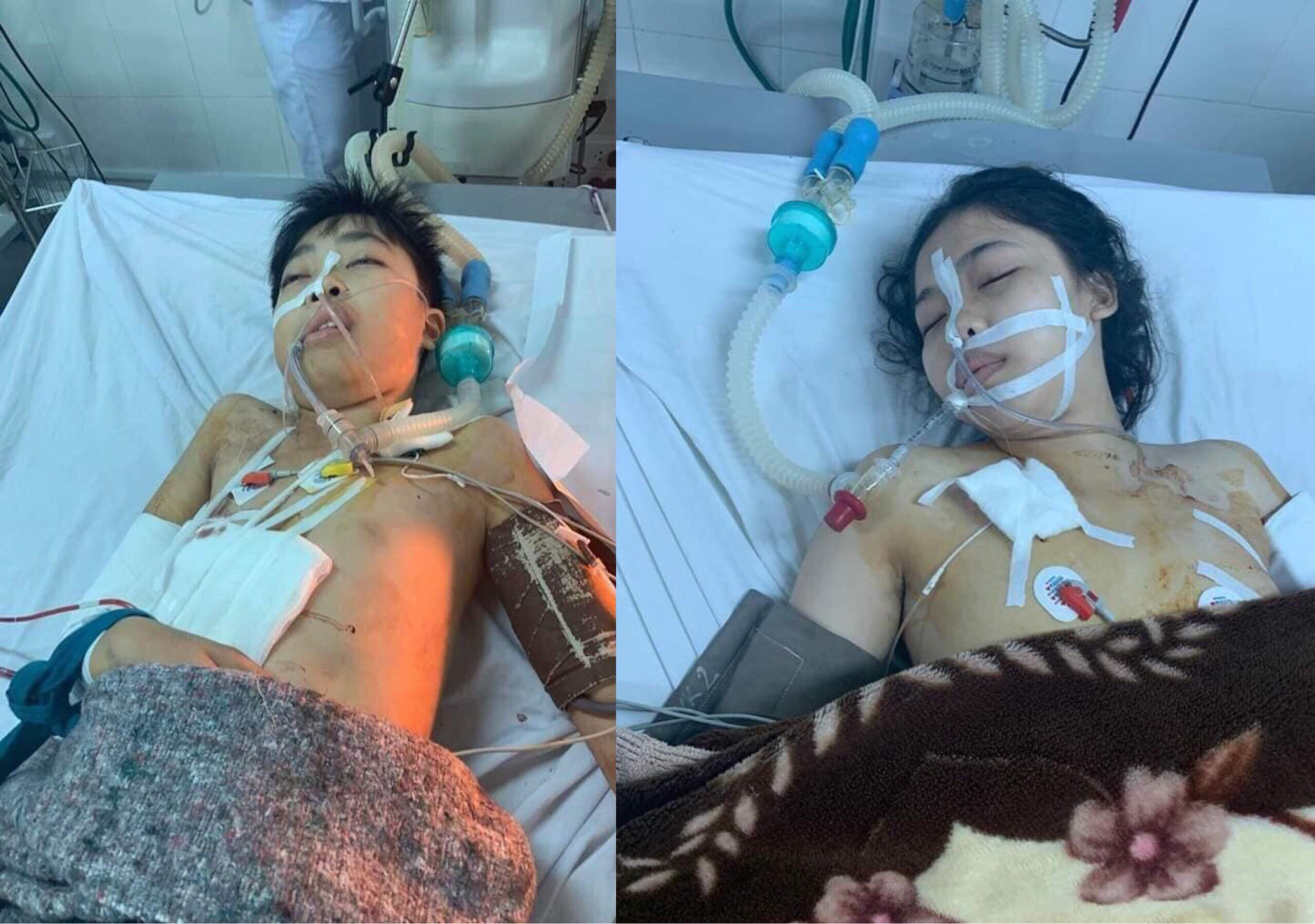 Hình ảnh đau xót trong bệnh viện của 2 cháu bé bị người tình của mẹ bắn. Cả hai đều đang nguy kịch.