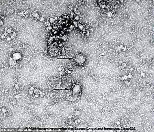 Hình ảnh coronavirus chủng mới (2019-nCov) do Trung tâm Dữ liệu Vi sinh Quốc gia Trung Quốc cung cấp, mẫu vật từ một bệnh nhân đại lục.