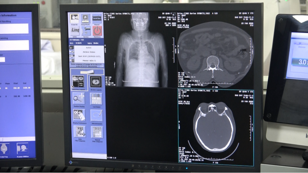bệnh nhân đang được chỉ định chụp CT ổ bụng, ngực; chụp MR sọ não, cột sống nhằm đánh giá tổn thương các cơ quan nhằm có hướng điều trị tối ưu.