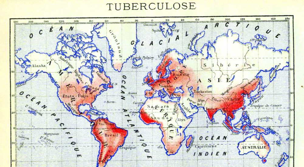 Bản đồ phân bố bệnh lao trên thế giới (Trung tâm Lịch sử y học, Đại học Harvard)
