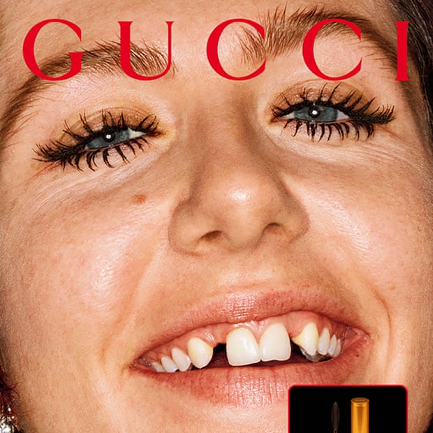 Gucci tiếp tục gây tranh cãi khi sử dụng người mẫu răng sún quảng ...