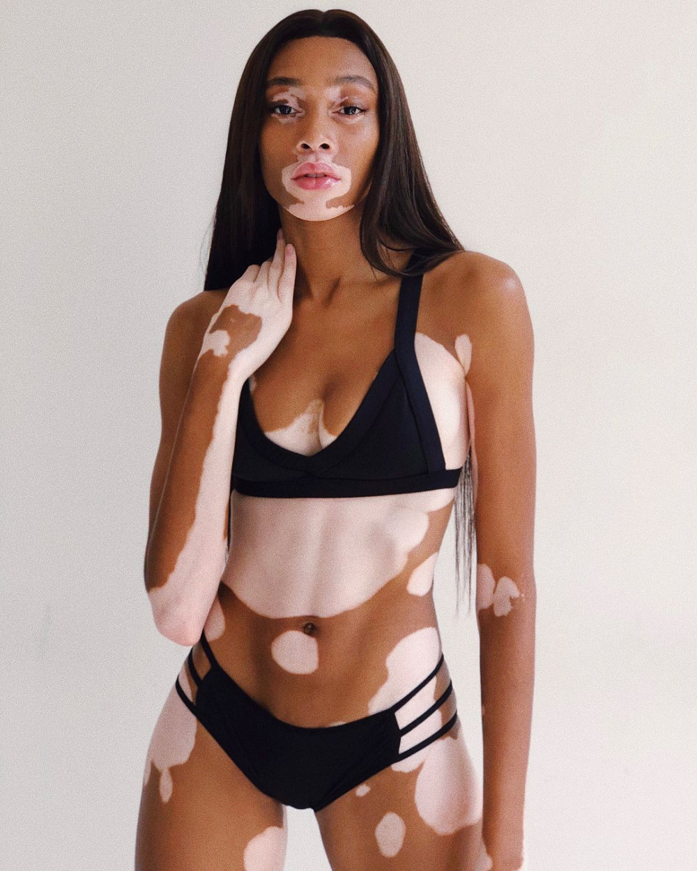 Winnie Harlow đang sở hữu trang cá nhân với hơn 7 triệu người theo dõi, cô còn trở thành gương mặt trang bìa của nhiều tạp chí nổi tiếng, được nhiều nhãn hàng săn đón bởi gu thời trang riêng biệt.