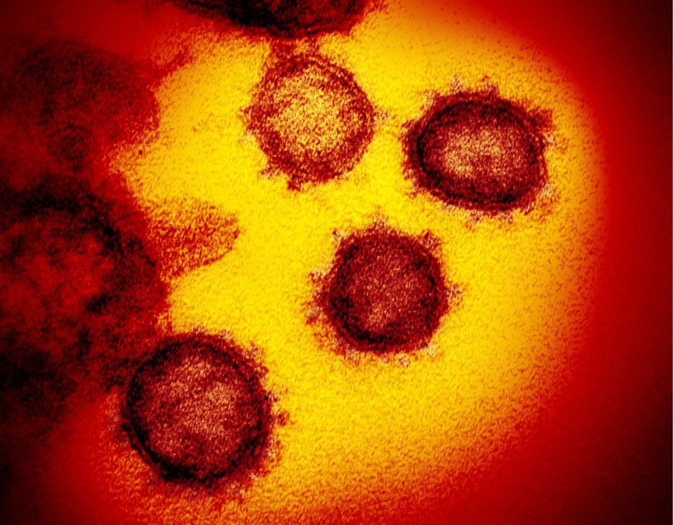 Virus SARS-CoV-2 gây bệnh viêm đường hô hấp cấp - Ảnh vi điện tử do Viện Dị ứng và Bệnh truyền nhiễm Quốc gia Mỹ (NIH) cung cấp