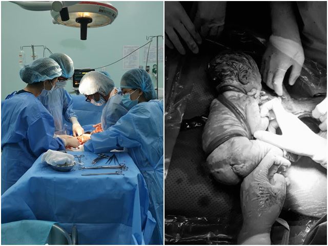 Ê kíp trực tại bệnh viện Hùng Vương đã phẫu thuật thành công cứu sống 1 ca hy hữu 