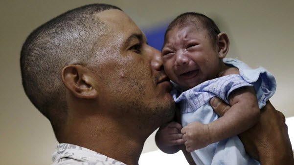 Virus Zika gây dị tật đầu nhỏ ở trẻ sơ sinh do truyền từ mẹ sang con - Hình minh họa