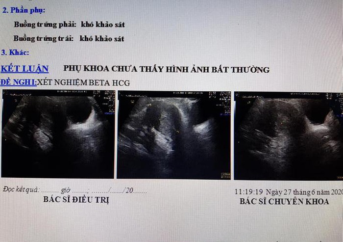 Kết quả siêu âm không có thai dù chị Nguyễn Thị D. mang bụng bầu - Ảnh: BV cung cấp