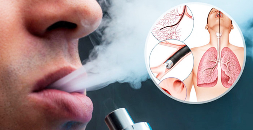 Giới trẻ bị thu hút bởi thuốc lá điện tử vì sản phẩm bắt mắt và nghĩ rằng sản phẩm này không gây độc hại như thuốc lá truyền thống