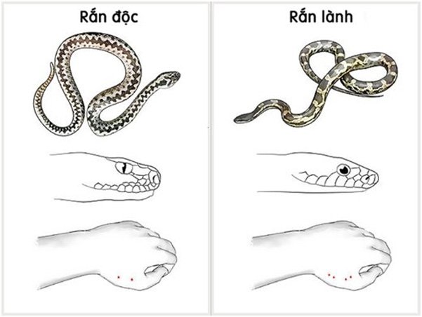 Cách phân biệt vết răng rắn độc cắn