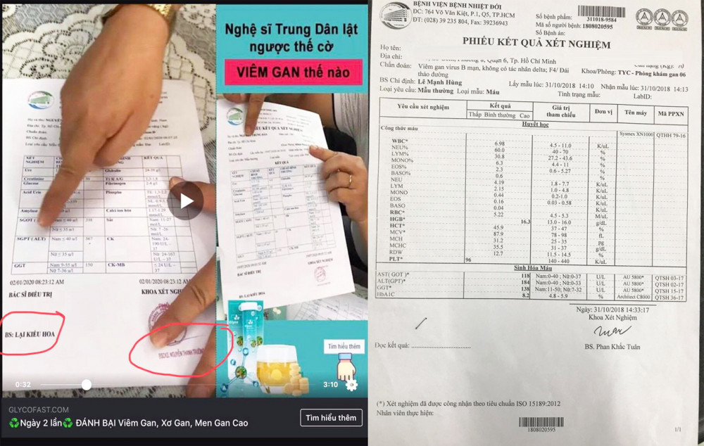 Mẫu phiếu kết quả xét nghiệm của nghệ sĩ Trung Dân trong clip (bên trái) sai hoàn toàn so với phiếu của Bệnh viện Bệnh nhiệt đới TP.HCM