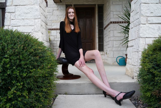 Cô bé tuổi teen Maci Currin đã xác lập kỷ lục với đôi chân dài nhất thế giới - Ảnh: Guinness World Records