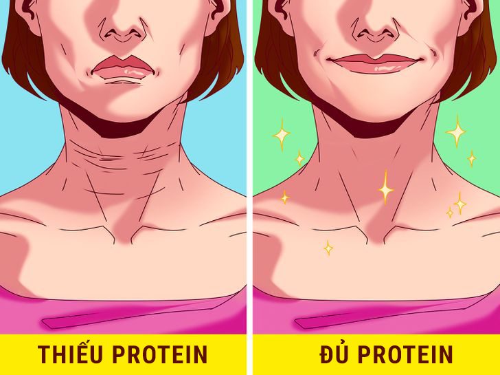 Nếu bạn hạn chế lượng calo và ăn ít protein, da của bạn sẽ mất độ đàn hồi, từ đó dẫn đến nhiều nếp nhăn hơn.  Điều trị bằng collagen thực sự có thể giúp ích trong những trường hợp này nhưng nó không thể so sánh với việc cơ thể hấp thụ trực tiếp protein.