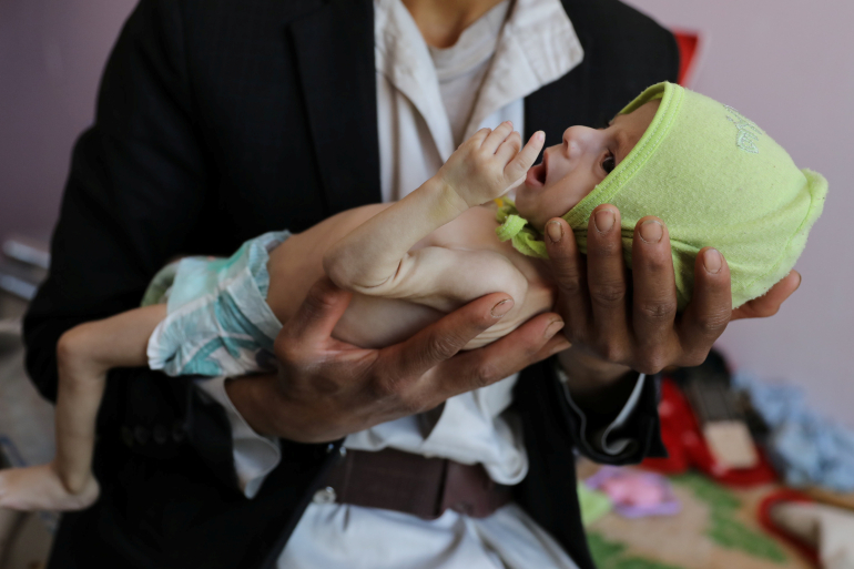 Người đàn ông bế cậu con trai suy dinh dưỡng đến khu điều trị dinh dưỡng Bệnh viện Al-Sabeen ở Sanaa, Yemen - Ảnh: Reuters