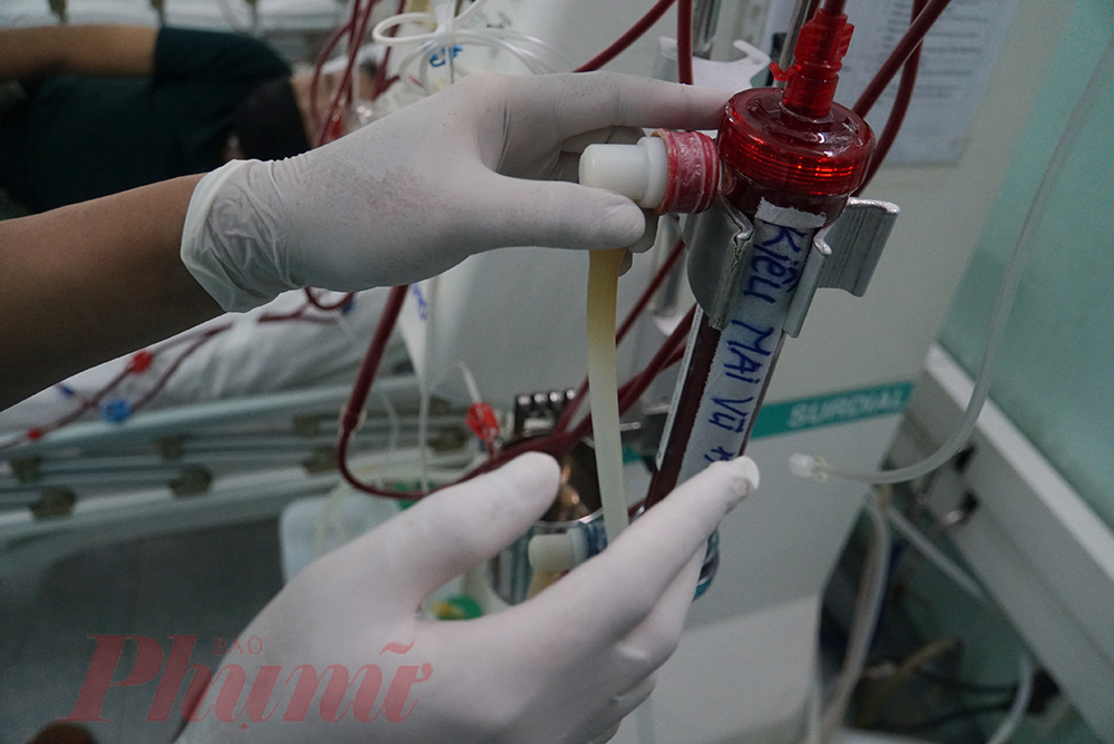 Khi nước muối đi qua, màn lọc của bệnh nhân sẽ được rửa, xả thải trực tiếp vào ống dẫn đến phễu hứng chứ không còn phải hứng vào xô như trước đây