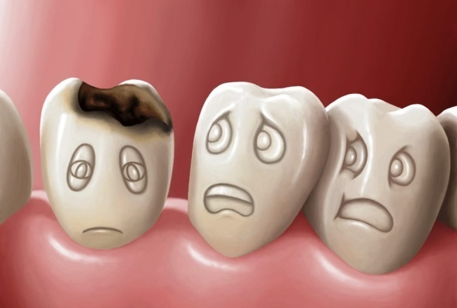 Thông thường, mọi người luôn nghĩ vệ sinh răng miệng sẽ dẫn đến sâu răng, nhưng chính stress cũng là một thủ phạm. Các chuyên gia nói rằng, stress dẫn đến việc bạn thường nghiến răng vào ban đêm, hoặc cả ban ngày. Nghiến răng là một thói quen xấu vì nó sẽ ăn mòn răng, làm tổn hại răng dẫn đến sâu răng.  Để giải quyết vấn đề, chúng ta hãy chuyển nỗi lo lắng của mình thành những con chữ. “Hãy dành thời gian để viết ra các vấn đề của bạn, nhìn nhận chúng theo hướng tích cực, và tự đề xuất ra những giải phá”. 