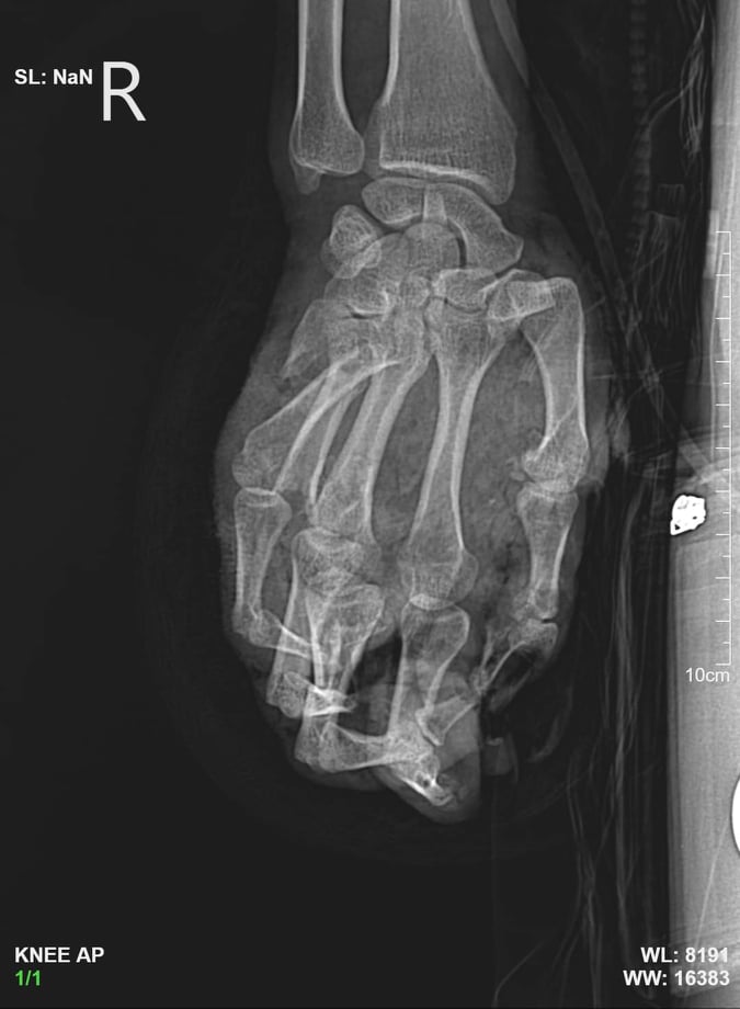 Hình ảnh chụp X-quang