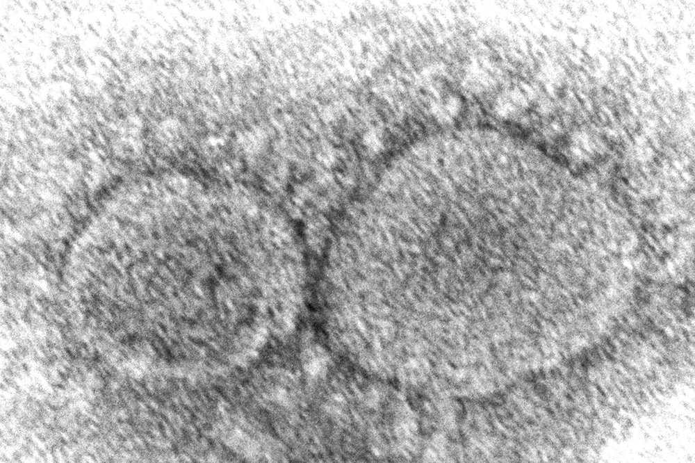 Hình ảnh hiển vi của vi-rút SARS-CoV-2 gây bệnh COVID-19