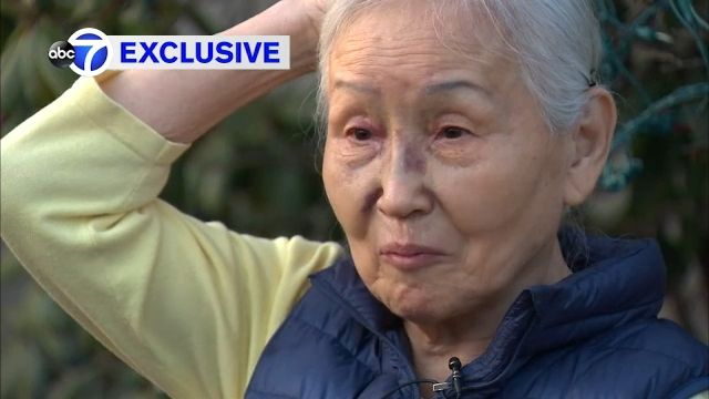 Một cụ bà người Mỹ gốc Á 83 tuổi bị một người đàn ông lạ mặt nhổ nước bọt, đấm vào mũi đến bất tỉnh trong một cuộc tấn công vô cớ - Ảnh: ABC News