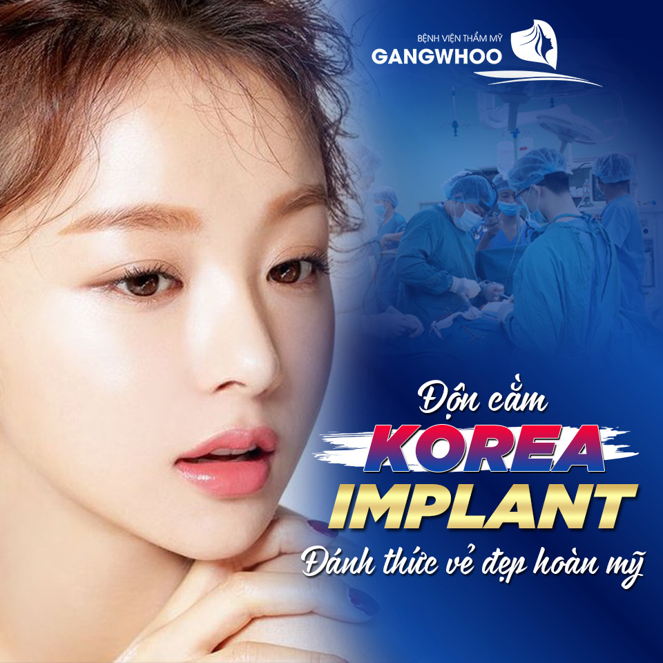 Korea Implant - công nghệ độn cằm được ưa chuộng tại Hàn Quốc