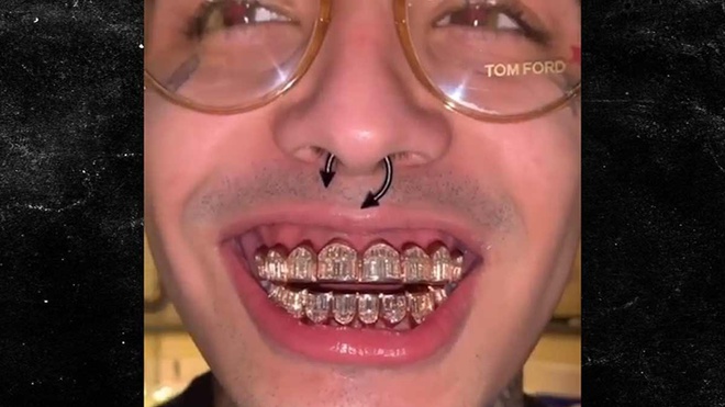 NTK kim hoàn gốc Việt Johnny Đặng từng thực hiện mẫu trang sức răng dành cho nhạc sĩ sinh năm 2000 Lil Pump. Thiết kế có giá 250.000 USD (khoảng hơn 5,7 tỷ đồng), gồm 165 viên kim cương khoảng 16 carat
