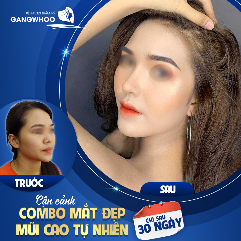 Nâng mũi Sline chuẩn nét đẹp người phụ nữ Á Đông - Ảnh: Gangwhoo