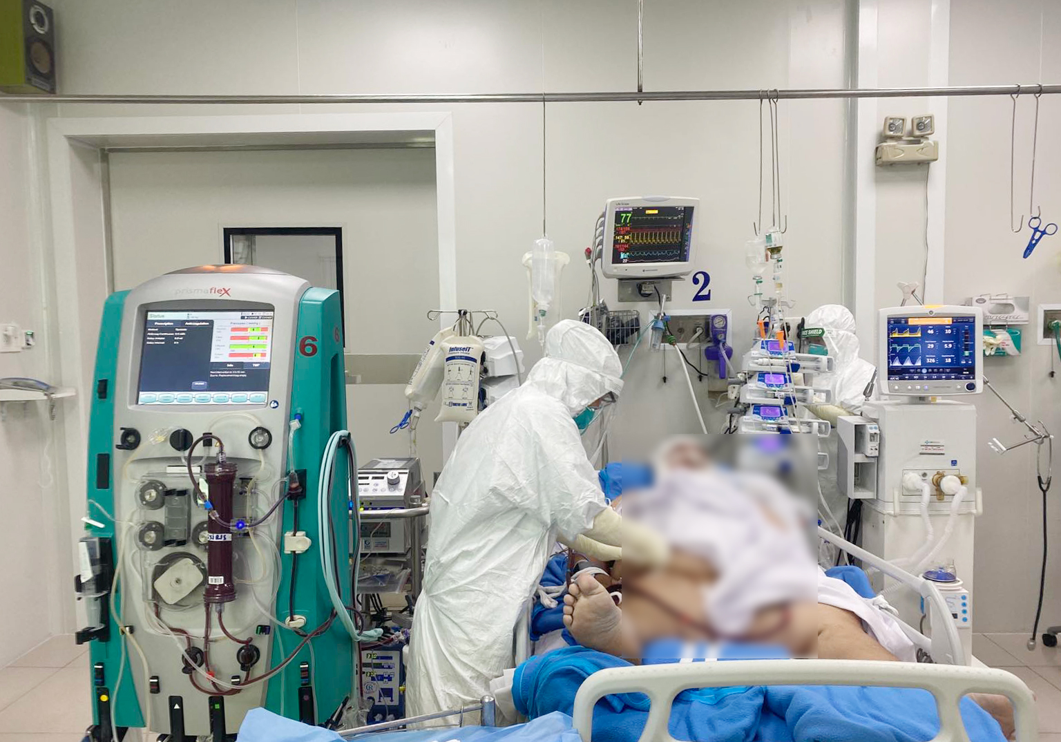 Bệnh nhân COVID-19 nặng đang được điều trị tại Bệnh viện Chợ Rẫy