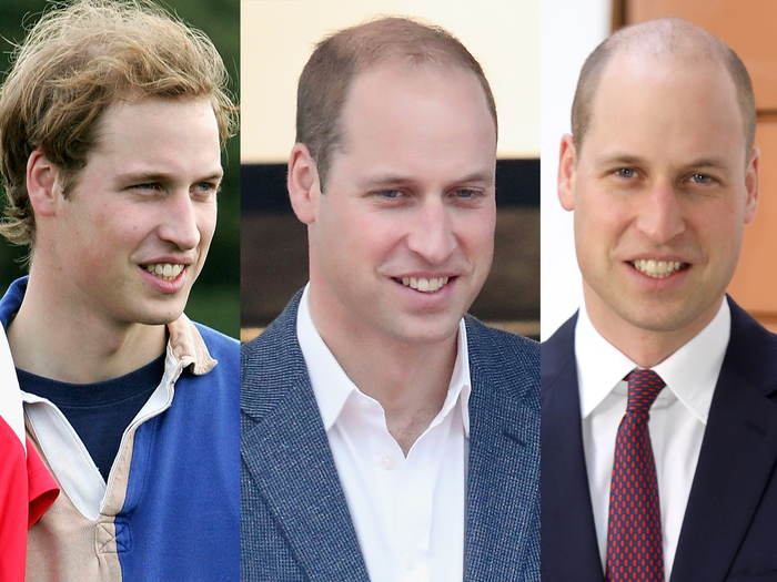 Sau khi cạo đầu, Hoàng tử William được nhận xét quyến rũ và nam tính hơn.