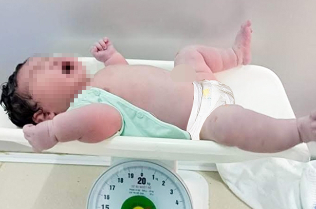 Cháu bé được các bác sĩ tại Bệnh viện đa khoa thị xã Kỳ Anh mổ đẻ với cân nặng 6,2kg