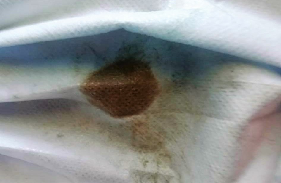 Người dân lấy khăn sạch bịt đầu vòi và xả nước một lúc vẫn có hiện tượng bẩn bám vào bề mặt khăn 