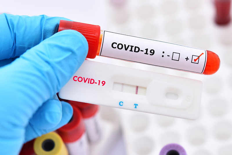 Các bệnh viện không được lạm dụng việc xét nghiệm kháng thể COVID-19