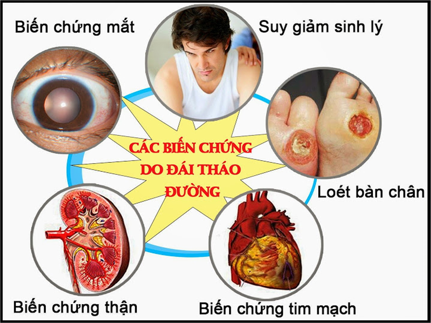 Các biến chứng của bệnh đái tháo đường - Ảnh: http://tytphuongbinhtridong.medinet.gov.vn