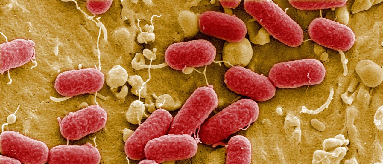 Vi khuẩn B pseudomallei tìm thấy trong bể cá cảnh - Ảnh: Manfred Rohde/HZI/Getty Images