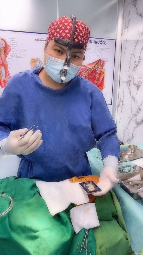 Nâng mũi sụn sườn được bác sĩ  khuyến cáo sử dụng khi mũi bị tổn thương nghiêm trọng do phẫu thuật thẩm mỹ thất bại - Ảnh: Gangwhoo