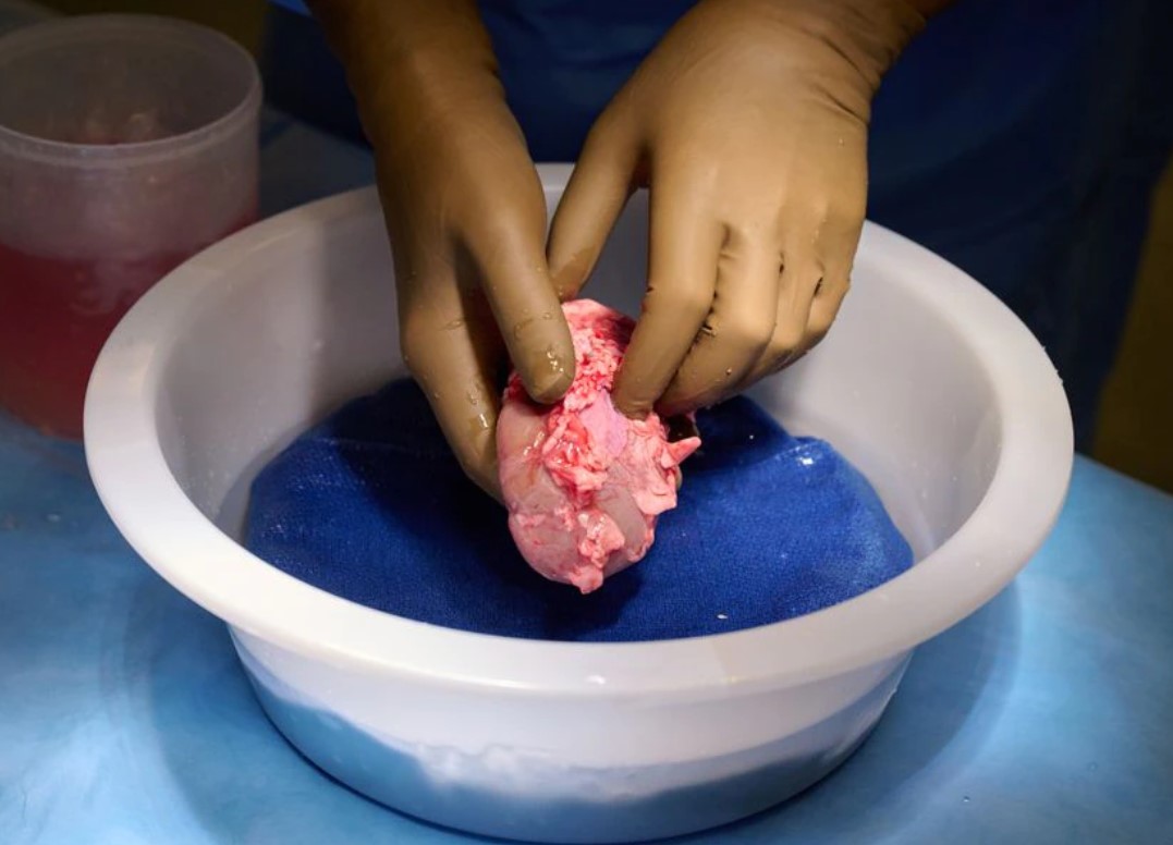Các bác sĩ tại Mỹ ghép thành công quả thận từ lợn biến đổi gen cho một bệnh nhân đã chết não mà không gặp phải triệu chứng loại thải