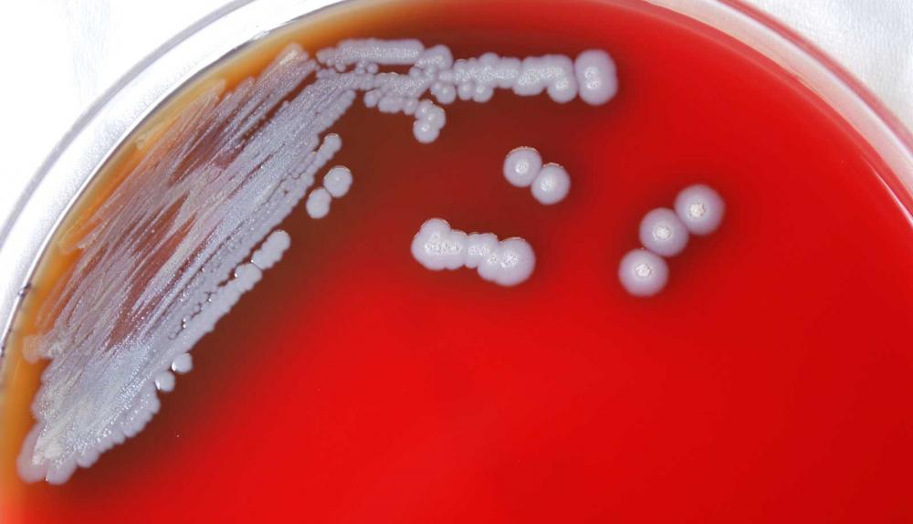 Vi khuẩn Burkholderia pseudomallei gây bệnh truyền nhiễm melioidosis - Ảnh: FDA