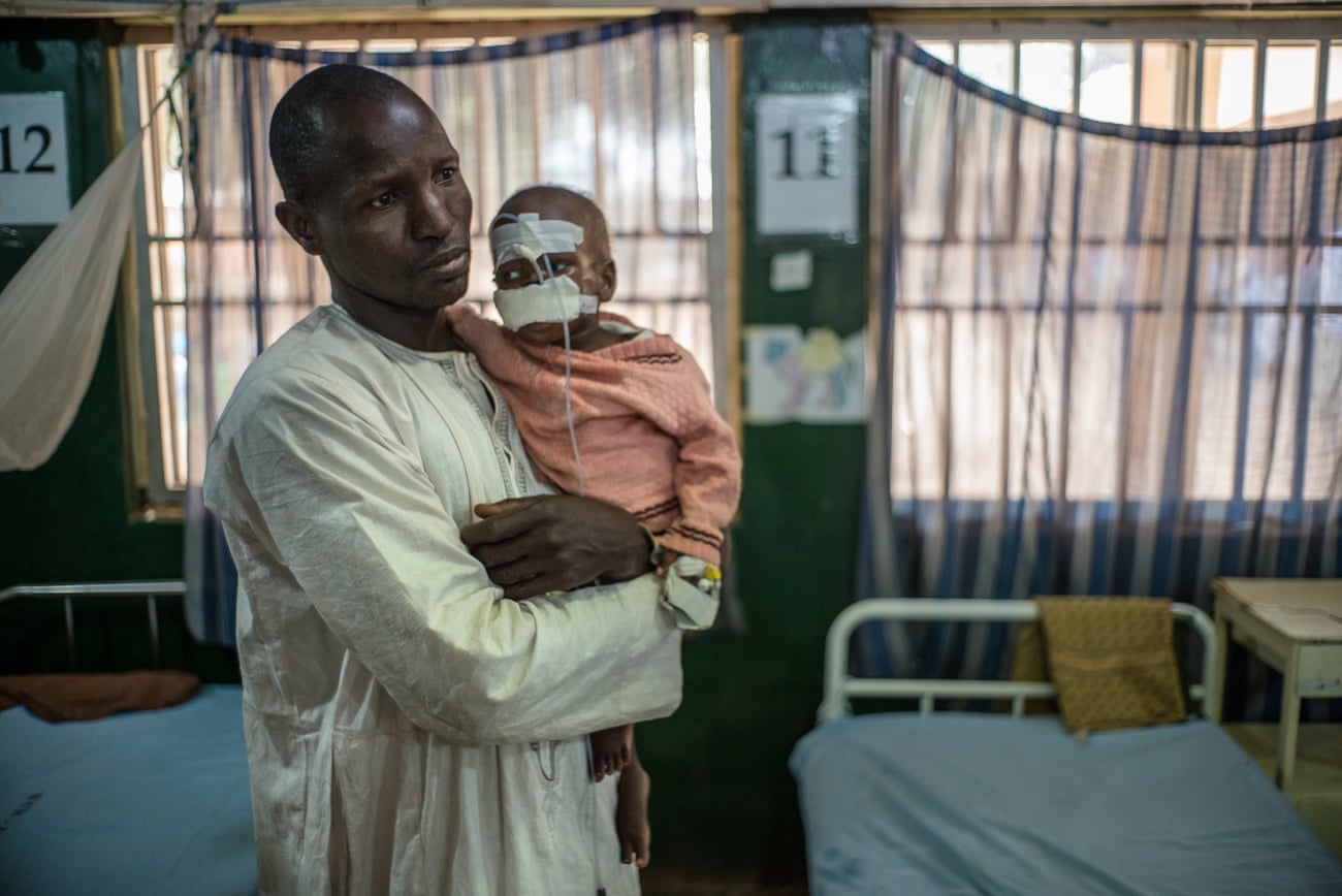 Grema và con trai Mohammed đến bệnh viện sau chuyến đi kéo dài hai ngày, nhưng khuôn mặt của Mohammed đã bị biến dạng. Ảnh: Claire Jeantet - Fabrice Caterini / Inediz