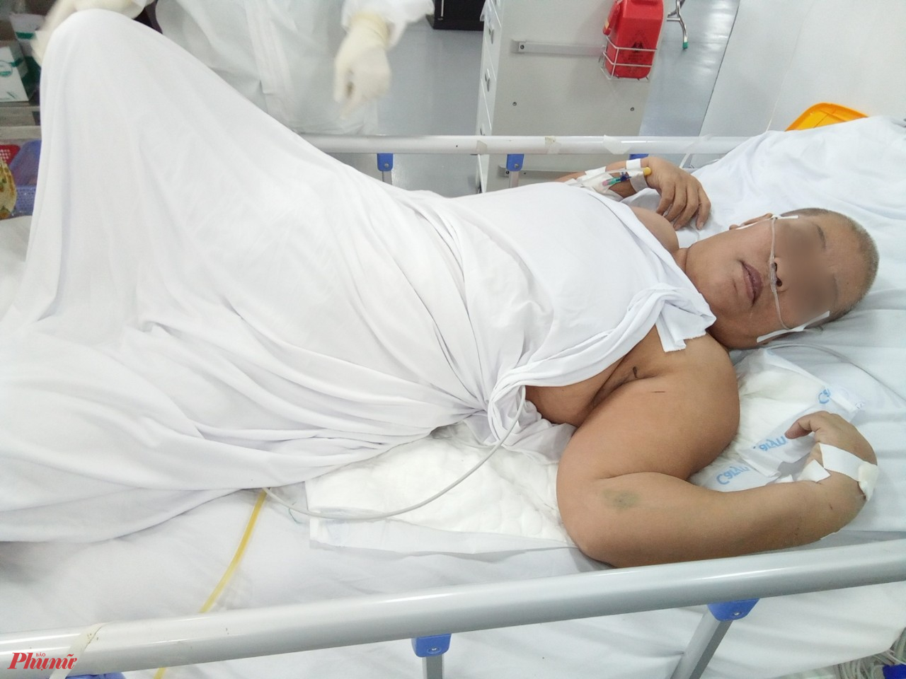 Nữ Bệnh nhân Phạm Thị P. có tiền sử béo phì, cao huyết áp