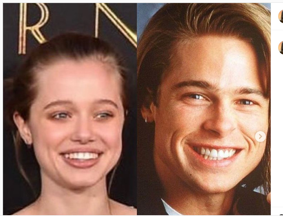 Phần lớn công chúng cho rằng Shiloh có đôi môi và đôi mắt của Angelina Jolie, trong khi lông mày, mũi và hình dạng khuôn mặt giống hệt Brad Pitt.