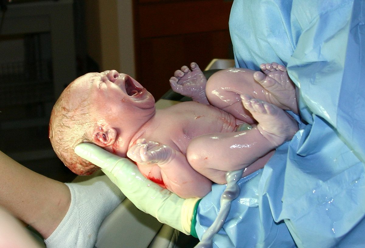 trẻ sơ sinh được cắt dây rốn muộn hơn 1 phút - thay vì ngay sau khi sinh - có tỷ lệ sống sót tốt hơn cho đến khi các bé được 2 tuổi