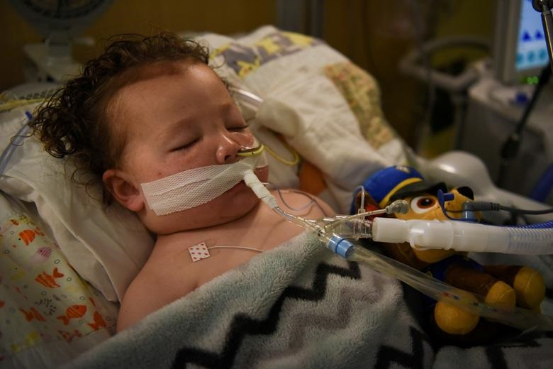 Adrian James (2 tuổi) nhiễm COVID-19 phải thở máy tại Bệnh viện Nhi đồng SSM Health Cardinal Glennon ở St. Louis, bang Missouri, ngày 5/10