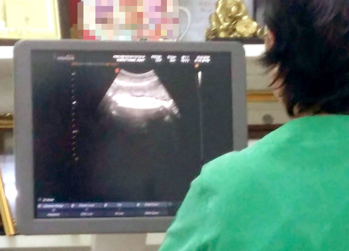 Bác sĩ siêu âm thai cho một trường hợp xin sinh con ở 36 tuần tuổi vì sợ con gái tuổi Dần - ẢNH: SƠN VINH