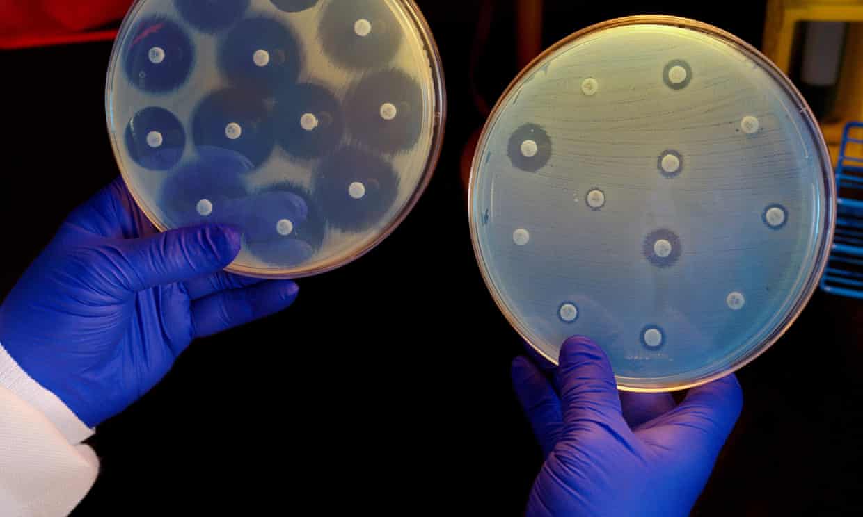 Một nhà nghiên cứu cầm hai đĩa nuôi cấy vi khuẩn với sự hiện diện của nhiều loại kháng sinh khác nhau. Ở đĩa bên trái, vi khuẩn phát triển mạnh và kháng lại hầu hết các kháng sinh hiện có