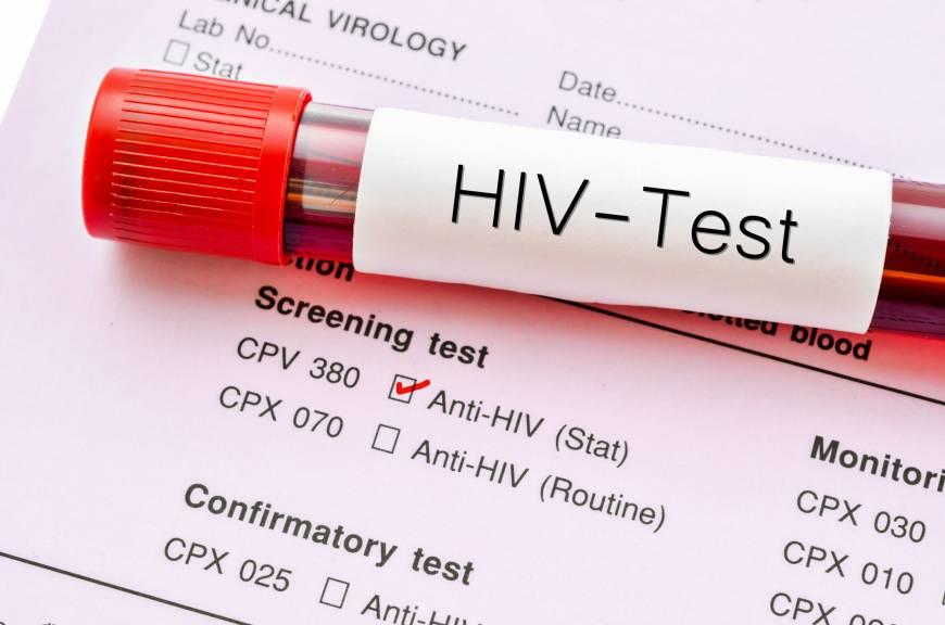 Việc xét nghiệm, chẩn đoán hát hiện sớm HIV là cực kỳ quan trọng trong điều trị và giảm nguy cơ lây nhiễm