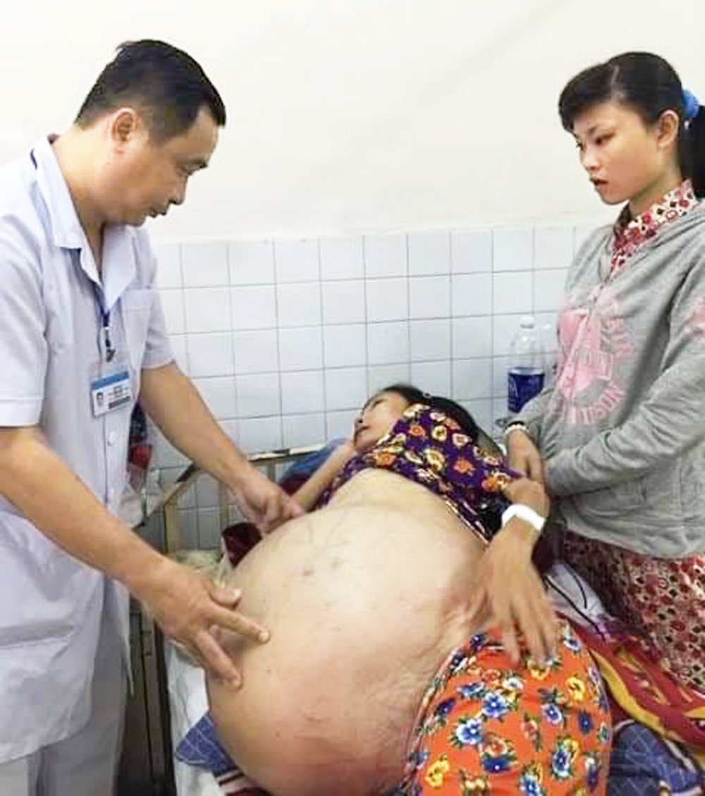 Bác sĩ Nguyễn Văn Tiến - chuyên gia xử lý  những khối bướu khổng lồ