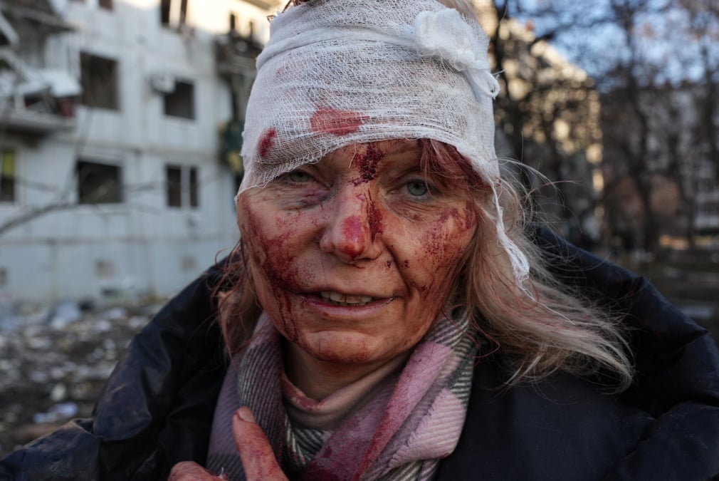 Một phụ nữ bị thương khi các cuộc công kích làm hư hại một khu chung cư bên ngoài Kharkiv, Ukraine.