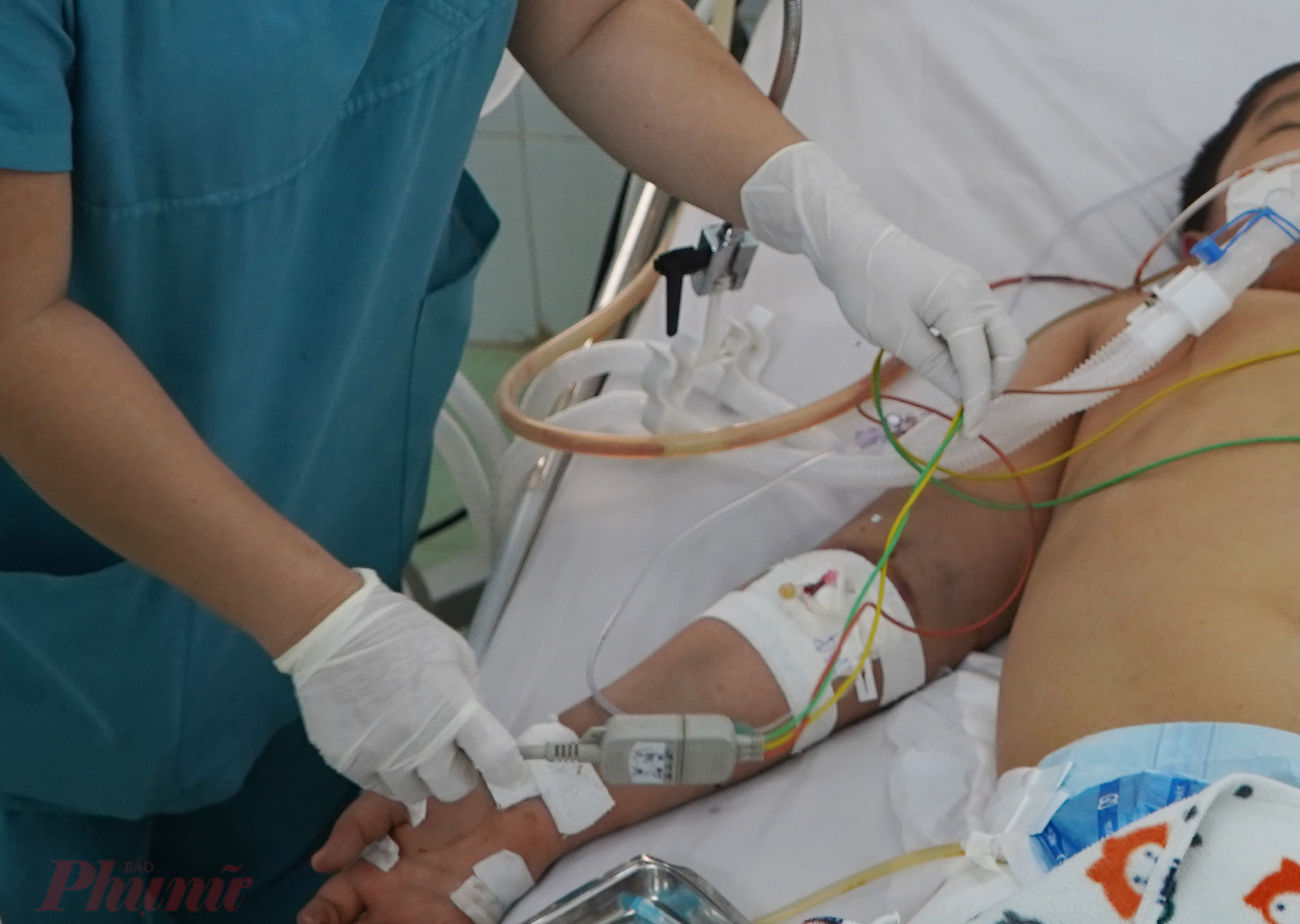 Trẻ mắc sốt xuất huyết nặng được điều trị tại khoa Nhiễm, Bệnh viện Nhi đồng 2 TPHCM