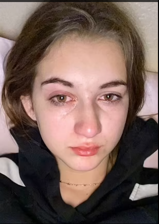  Abigail không thể khóc bởi khi khóc mắt cô rất đau rát, da ngoài vùng mắt như bị bỏng