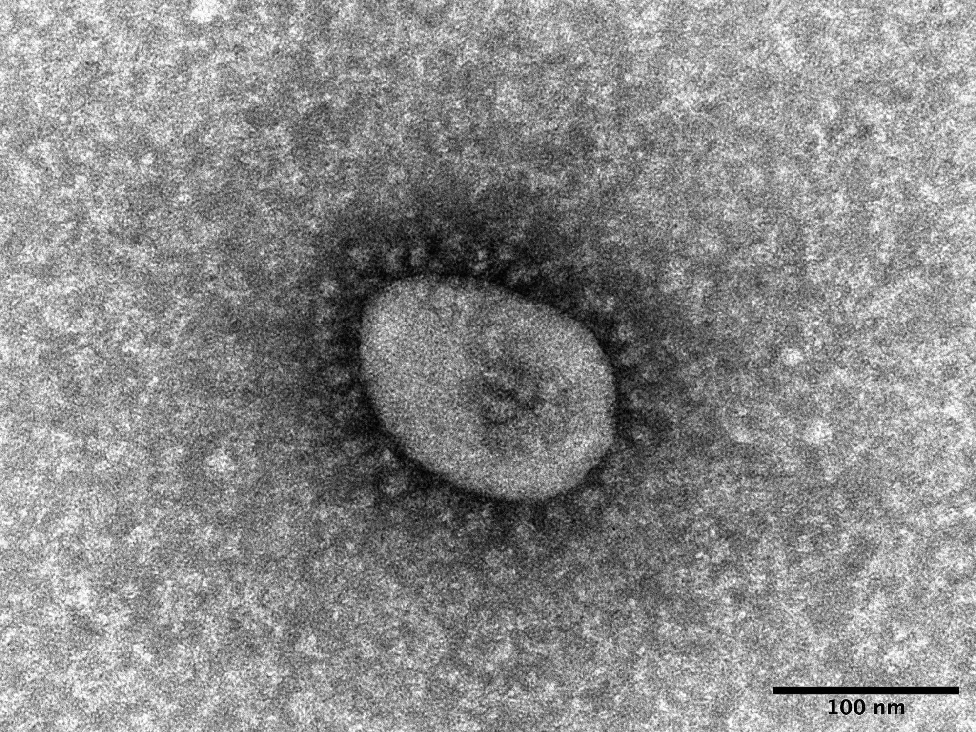 Biến thể omicron của coronavirus khi được nhìn thấy qua kính hiển vi | VIỆN BỆNH TRUYỀN NHIỄM QUỐC GIA / VIA KYODO