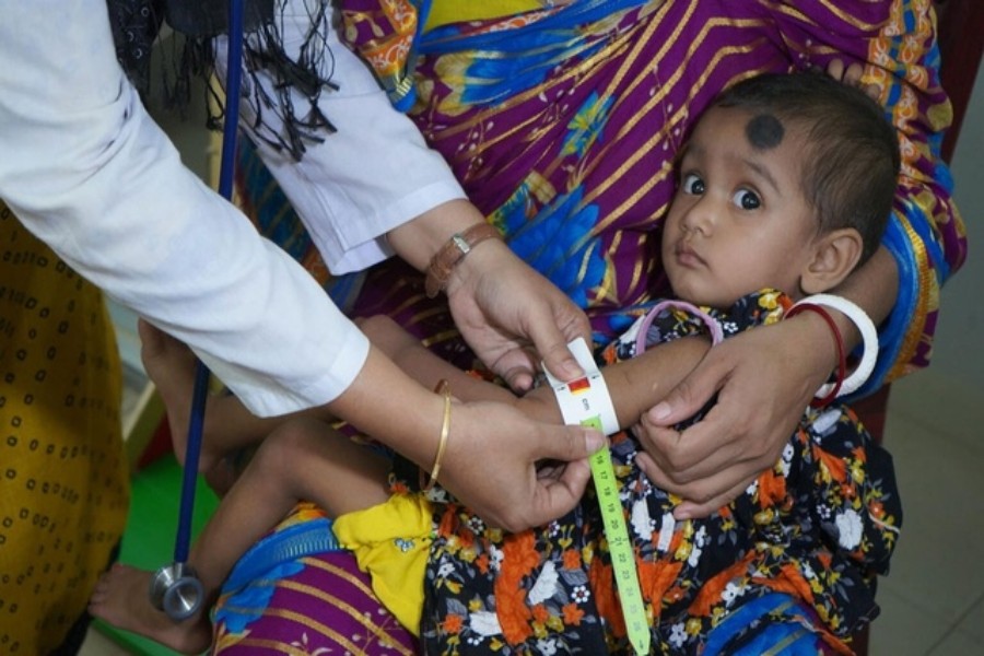 Bác sĩ của UNICEF đang khám suy dinh dưỡng cho một em bé ở vùng Hạ Sahara