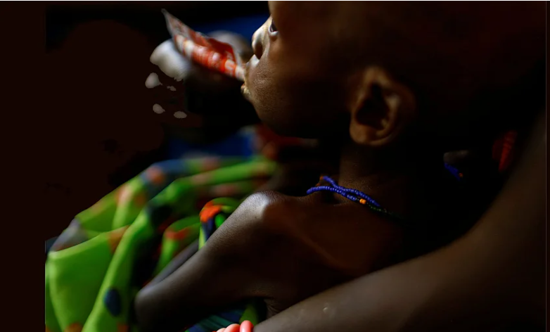 Một đứa trẻ được mẹ bế khi cho ăn gói thực phẩm chữa bệnh bán sẵn ở Somalia.